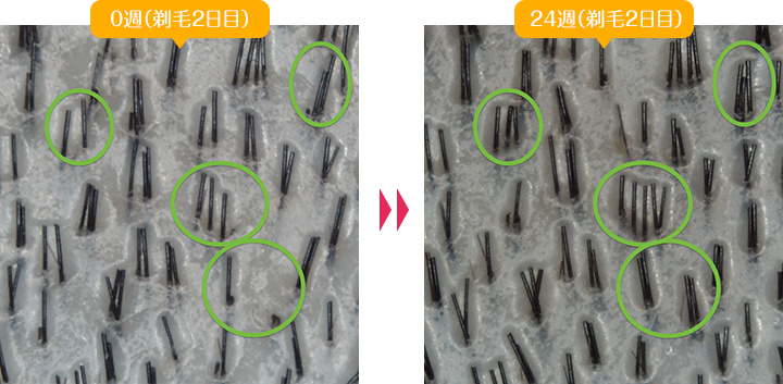 0週（剃毛2日目）→24週（剃毛2日目）