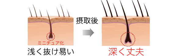 浅く抜けやすい 摂取後 → 深く丈夫